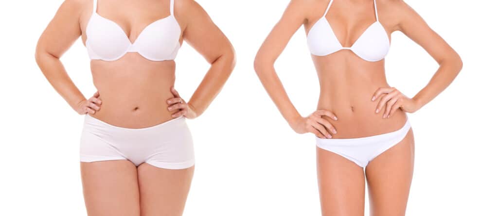 Sarasota's Top Semaglutide Weight Loss Clinic